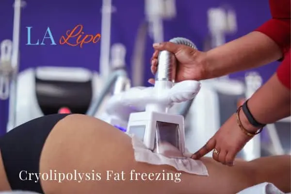 women getting fat freezing Ross-on-Wye