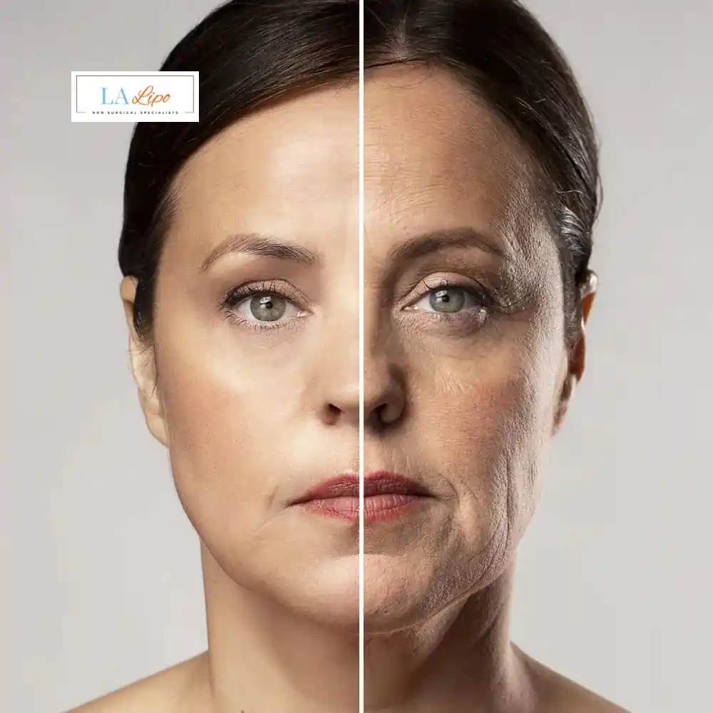 How Can You Tell If Non-Surgical Skin Tightening Is Right for You Ross-on-Wye?