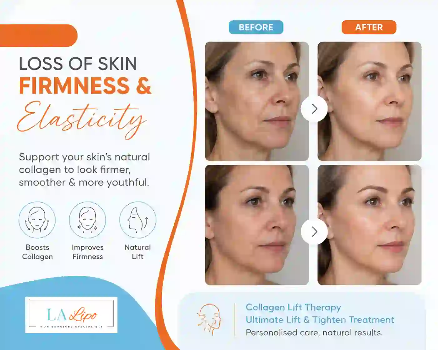 Sign #7: Loss of Skin Firmness and Elasticity Ross-on-Wye